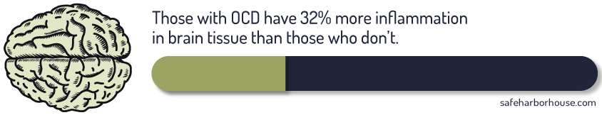 Obsessive-Compulsive Disorder Those With OCD Have 32 Percent More Inflammation in Brain Tissue Than Those Who Dont